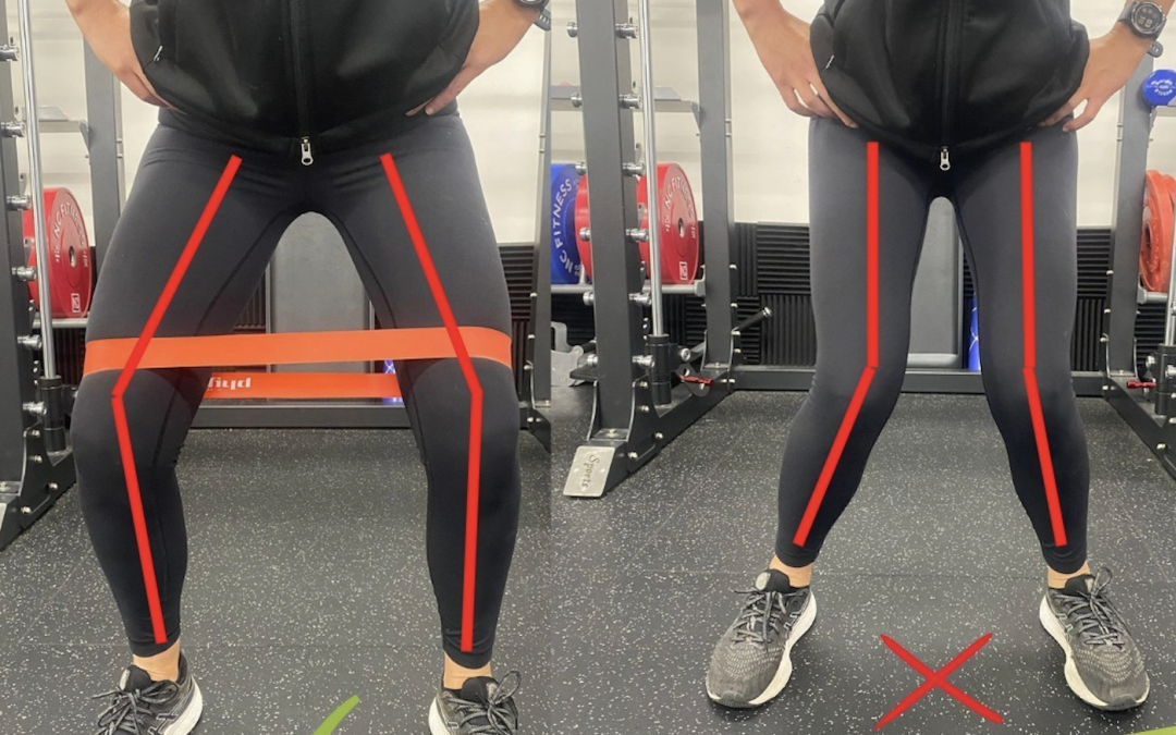 Valgus Collapse of the knee: What is it and how to fix it?