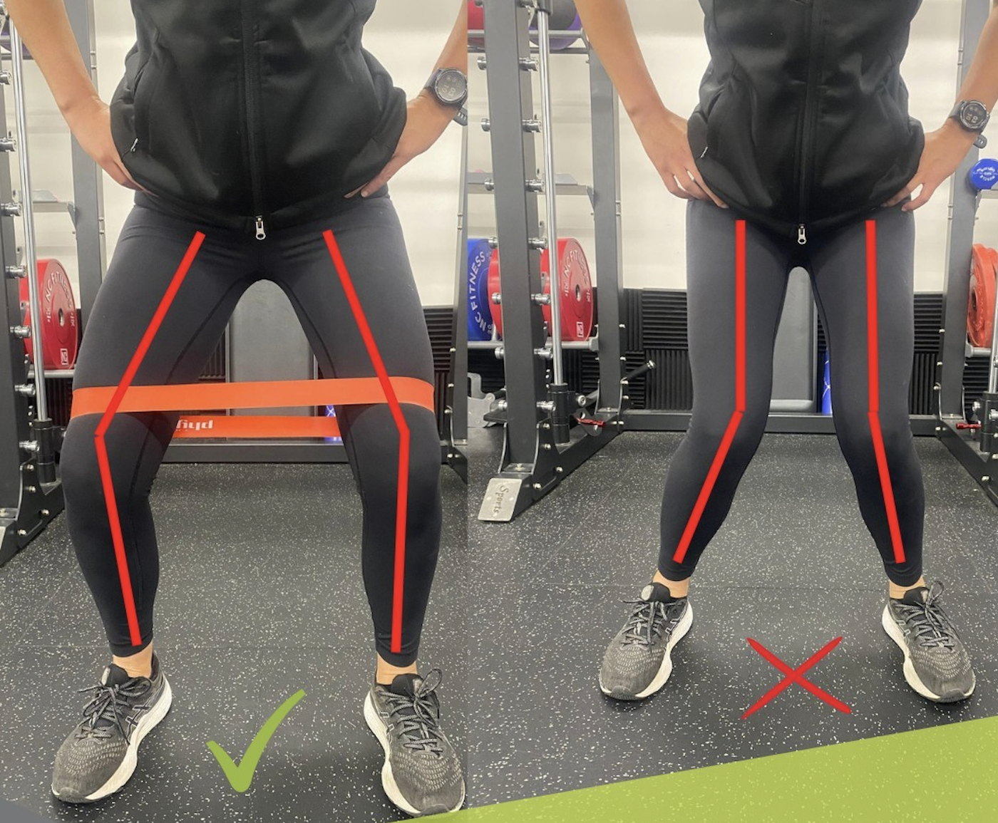 Knee collapse, also known as valgus collapse, when squatting is very common. ⁠ ⁠A valgus collapse in a squat may not be due to any issues with the knee.
