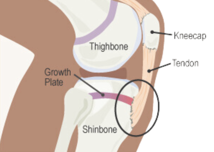 single limb exercises for building strength and stability