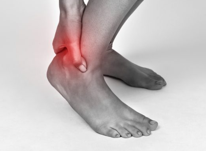 Achilles Tendinopathy 