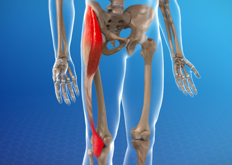 Iliotibial Band Syndrome